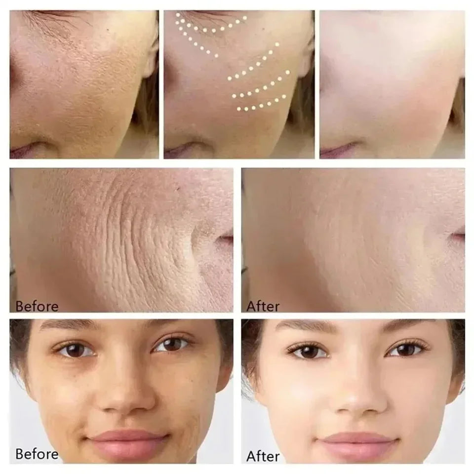 Retinol Wrinkle Removal Facial Kit Instant Firming Enhancement Anti Aging Serum Fading Fine Line Whitening Korean Skincare Survival Dog