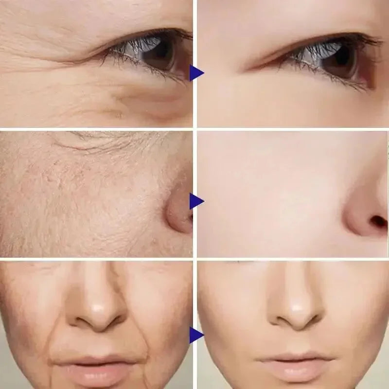 Retinol Wrinkle Removal Facial Kit Instant Firming Enhancement Anti Aging Serum Fading Fine Line Whitening Korean Skincare Survival Dog