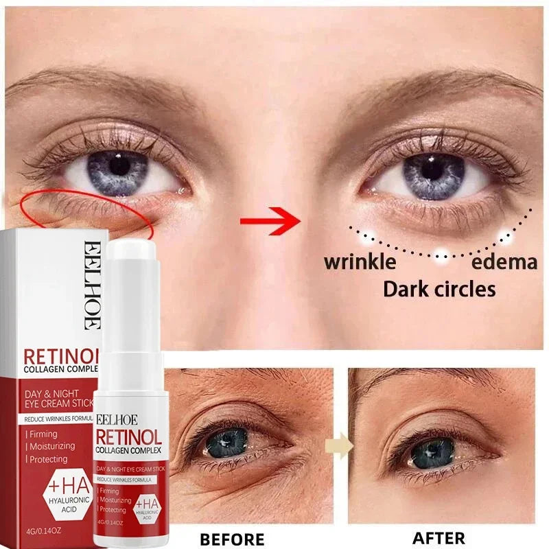 Retinol Wrinkle Removal Facial Kit Instant Firming Enhancement Anti Aging Serum Fading Fine Line Whitening Korean Skincare Survival Dog