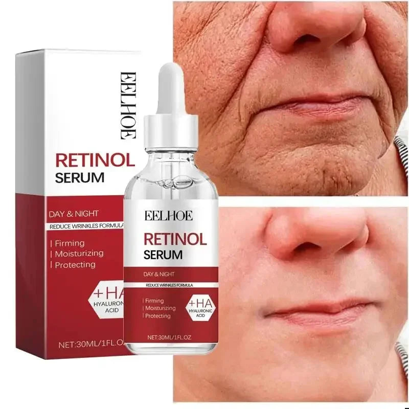 Retinol Wrinkle Removal Facial Kit Instant Firming Enhancement Anti Aging Serum Fading Fine Line Whitening Korean Skincare Survival Dog