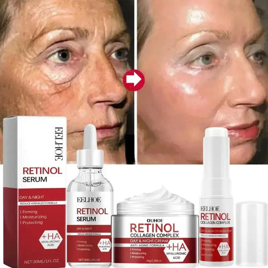 Retinol Wrinkle Removal Facial Kit Instant Firming Enhancement Anti Aging Serum Fading Fine Line Whitening Korean Skincare Survival Dog